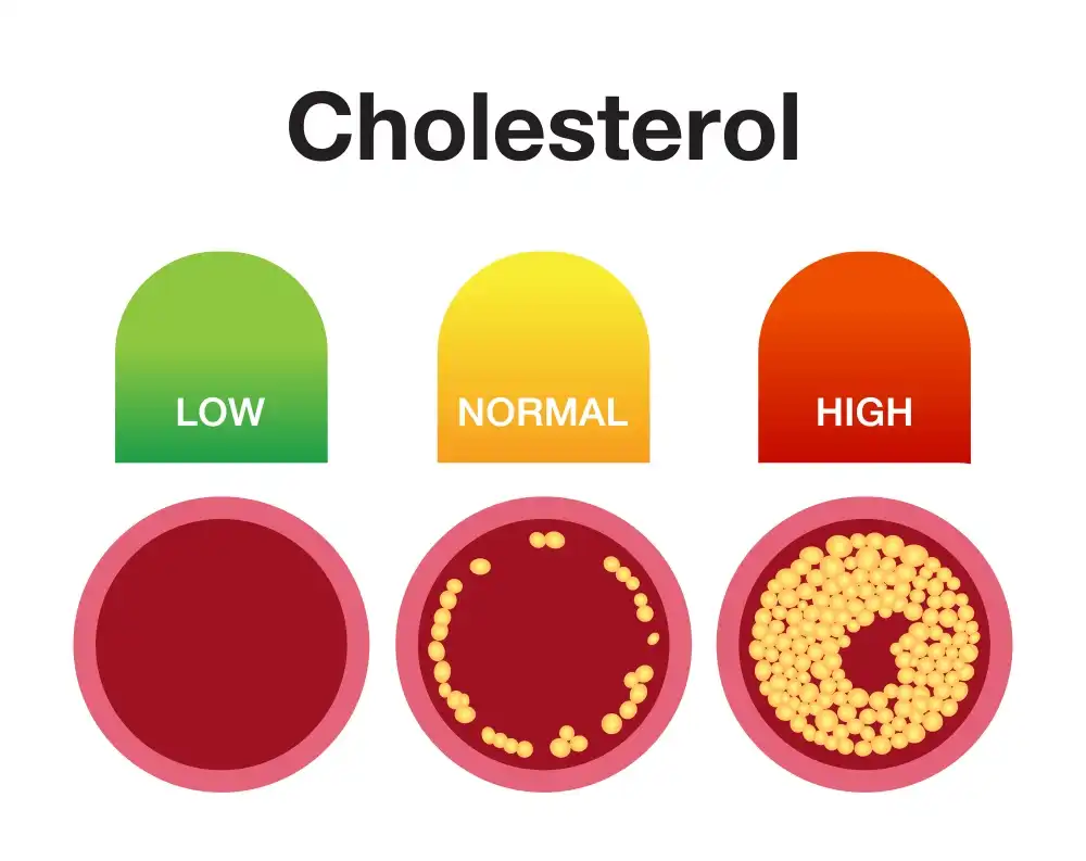 cholesterol