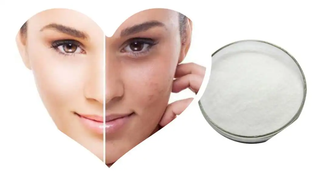 Pure Monobenzone Powder Pure Monobenzone Powder