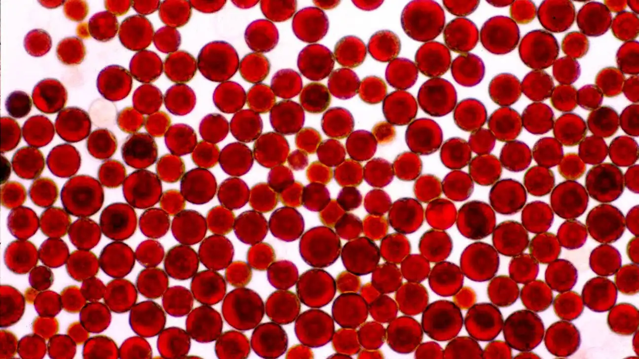  Haematococcus pluvialis